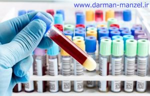 آزمایش‌های تشخیصی بر روی خون انسان
