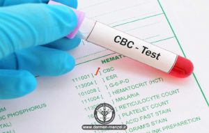 آزمایش cbc چیست ؟