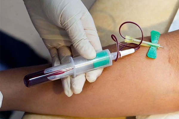 تفسیر علامت RBC در برگه آزمایش میزان نرمال آن-درمان در منزل